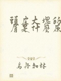 头皮大块的头皮屑是什么原因