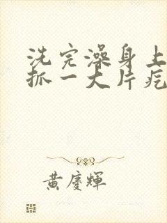 洗完澡身上痒一抓一大片疙瘩