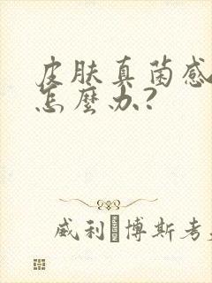 皮肤真菌感染了怎么办?