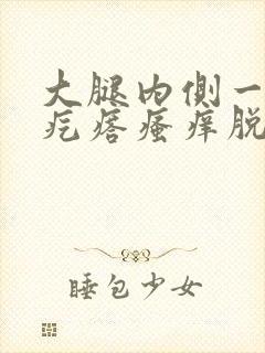 大腿内侧一片红疙瘩瘙痒脱皮