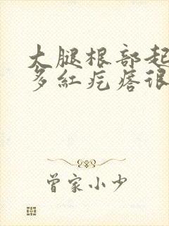 大腿根部起了好多红疙瘩很痒怎么回事