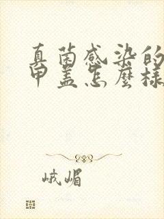 真菌感染的脚指甲盖怎么样才能好