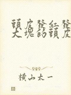 头皮发红发痒有大块的头皮屑是怎么回事封面