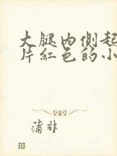 大腿内侧起了一片红色的小疙瘩