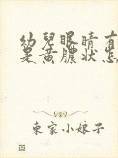 幼儿眼睛有眼屎是黄脓状怎么办