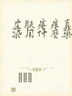 皮肤瘙痒真菌感染用什么药膏