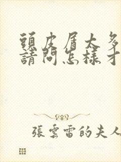 头皮屑太多了,请问怎样才能祛除