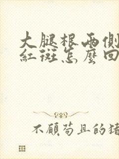 大腿根两侧出现红斑怎么回事