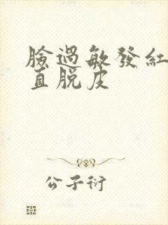 脸过敏发红还一直脱皮