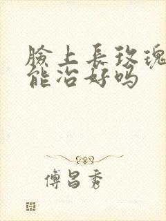 脸上长玫瑰痤疮能冶好吗