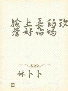 脸上长的玫瑰痤疮好治吗