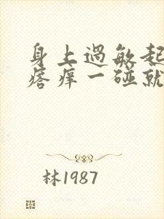 身上过敏起红疙瘩痒一碰就疼