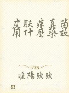 皮肤痒真菌感染用什么药效果好