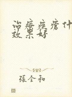 治疗痤疮什么药效果好