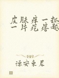 皮肤痒一抓就起一片疙瘩越挠越痒用什么药