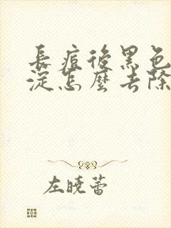 长痘后黑色素沉淀怎么去除