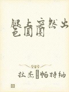 腿上突然出现红色圆圈