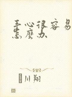 手心很容易出汗怎么办