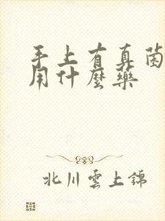 手上有真菌感染用什么药