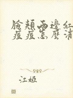 脸颊两边红红的痘痘怎么消除