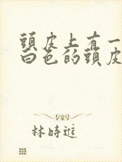 头皮上有一大块白色的头皮屑