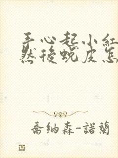 手心起小红疙瘩然后蜕皮怎么回事