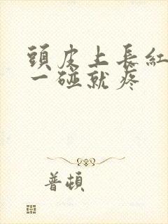 头皮上长红疙瘩一碰就疼