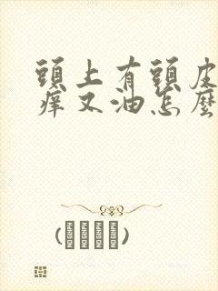 头上有头皮屑头痒又油怎么办