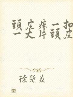 头皮痒一扣就是一大片头皮屑