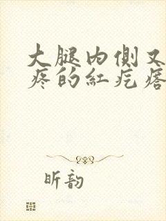 大腿内侧又痒又疼的红疙瘩