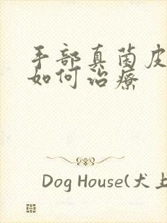 手部真菌皮肤病如何治疗封面