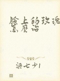 脸上的玫瑰痤疮怎么治