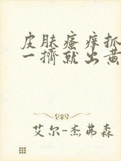 皮肤瘙痒抓破后一挤就出黄水