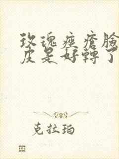 玫瑰痤疮脸上起皮是好转了吗