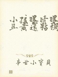 小孩眼睛眼屎多且黄还粘稠怎么办