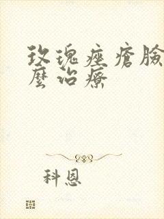 玫瑰痤疮脸部怎么治疗