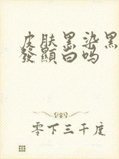 皮肤黑染黑色头发显白吗