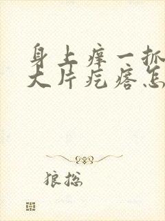 身上痒一抓就起大片疙瘩怎么办