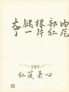 大腿根部内侧起了一片红疙瘩痒女性