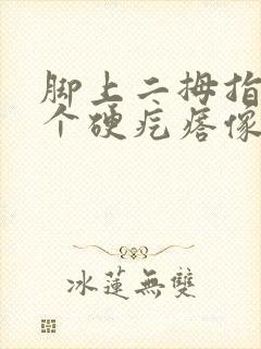 脚上二拇指长了个硬疙瘩像茧按着疼封面