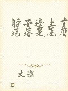 脖子边上有个小疙瘩是怎么回事