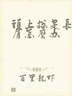 头上总是长头皮屑怎么办封面