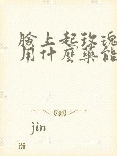 脸上起玫瑰痤疮用什么药能治好