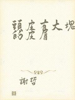 头皮有大块白色的皮屑