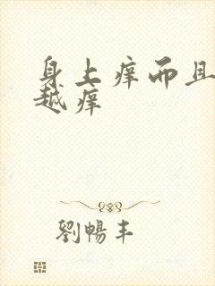 身上痒而且越抓越痒封面