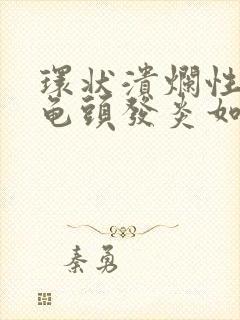 环状溃烂性包皮龟头发炎如何治疗