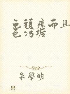 龟头痒而且有白色污垢