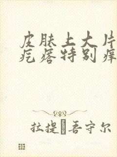 皮肤上大片的扁疙瘩特别痒是什么