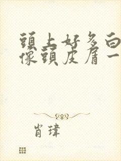 头上好多白色的像头皮屑一样