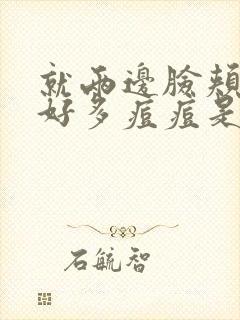 就两边脸颊长了好多痘痘是为什么